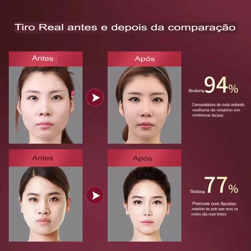 Dispositivo Facial de Fototerapia LED e Massagem Vibratória para Lifting - Imagem 15